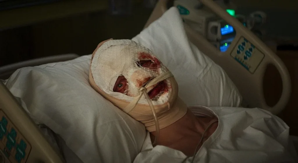 Matt Hagen lying in a hospital bed with his face bandaged after the attack in Clayface (2026)